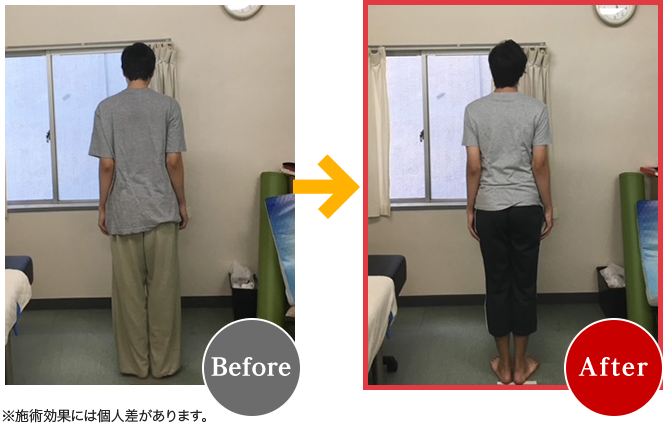 Before After